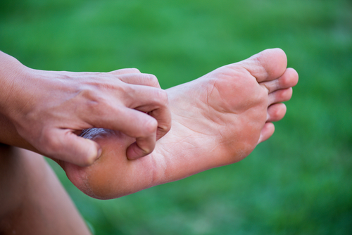 dermatologists thomasville nc athletes foot