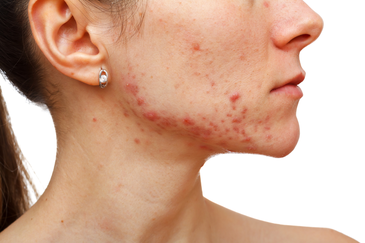 Itchy Skin Rash Dermatology Treatment