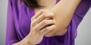 Dermatologists Explain 3 Causes of Eczema - Thomasville